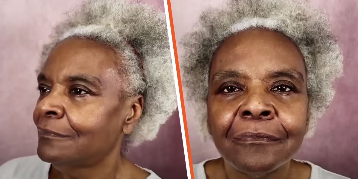 A Surgeon Son Performed Plastic Surgery on His 68-Year-Old Mom, Who Was Amazed by the Results — Before & After Photos Stun